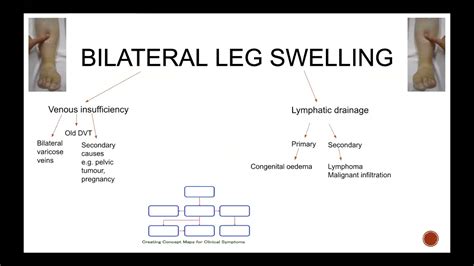 Bilateral Peripheral Edema