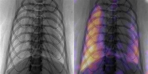 X-Ray Phase-Contrast (XPC) Imaging and Tomography – Computational Imaging Science Laboratory