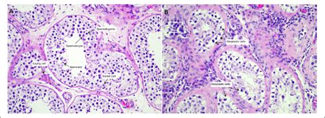 Histologic features. A, Histology of normal seminiferous tubule (Â400).... | Download Scientific ...