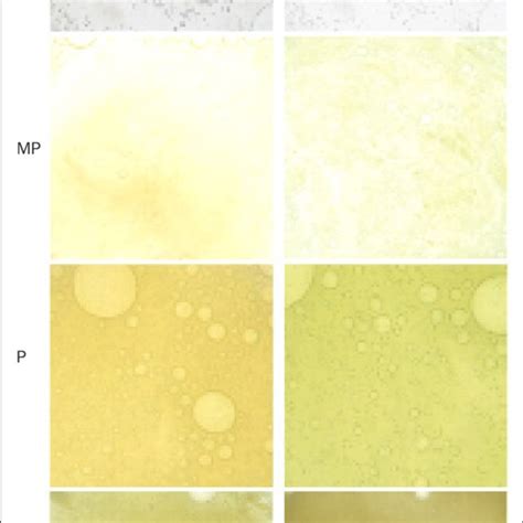 (PDF) The importance of obtaining a sputum sample and how it can aid diagnosis and treatment