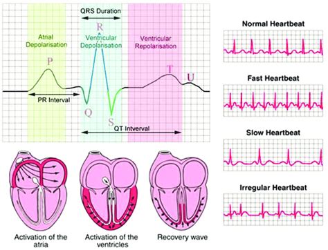 (ECG) 1. 심전도 분석에 관해