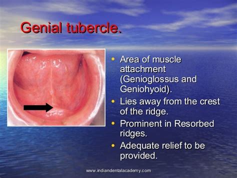 Genial Tubercles Definition