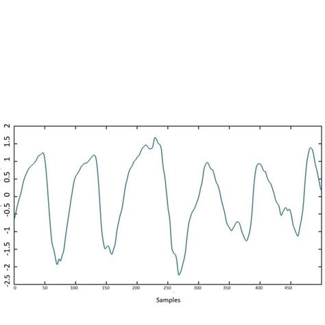 Comparison of automated shockable and non-shockable system using ECG ...