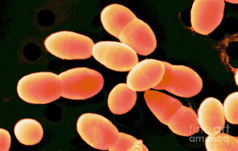 Lactococcus Lactis Photograph by Scimat - Pixels