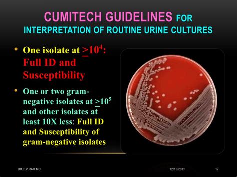 PPT - Interpretation of Urine Cultures PowerPoint Presentation, free download - ID:212996