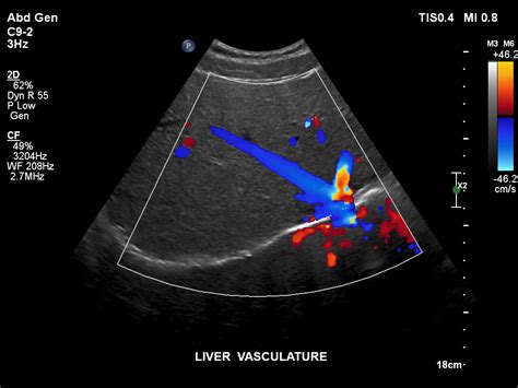 Ultrasound - Carlsbad Imaging Center - Imperial Radiology