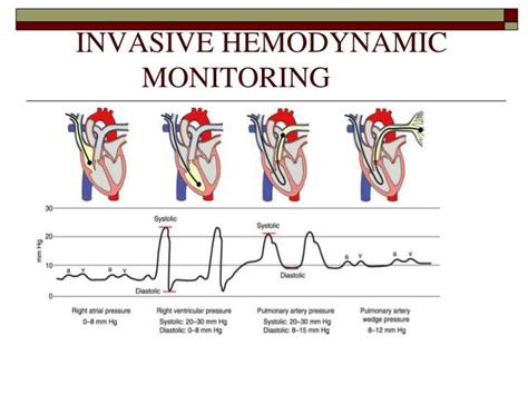 PPT - INVASIVE HEMODYNAMIC MONITORING PowerPoint Presentation - ID:6333249