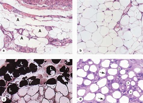 Adipose Connective Tissue Labeled