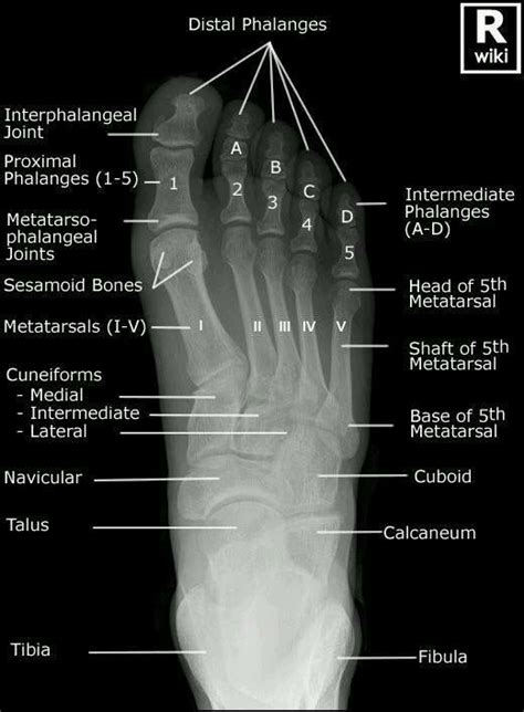 funzonehere.cf | Radiology student, Radiology, Medical anatomy