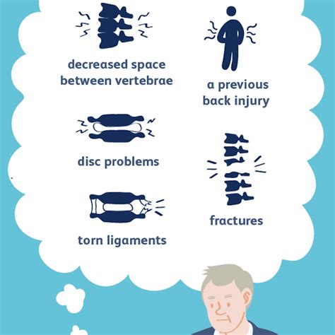 Facet Arthropathy Symptoms and Treatments