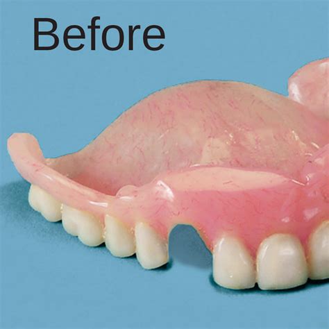 Denture Repair Kit - Denture Repair Adhesive - Easy Comforts