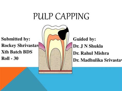 Pulp capping