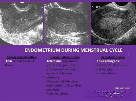 Obstetric Ultrasound, Ultrasound Sonography, Sonography Student ...