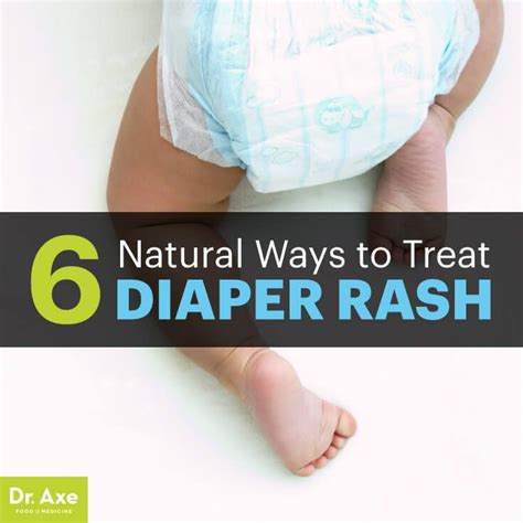 6 Diaper Rash Treatments | Rash treatment