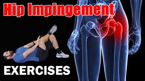 How To Treat Hip Impingement – Otosection