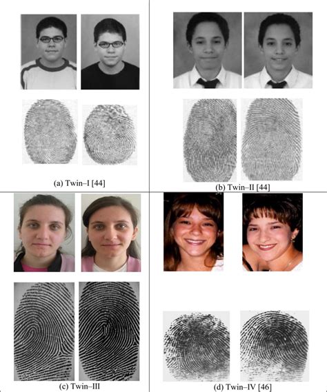 fun animal in: Do Twins Have Identical Fingerprints