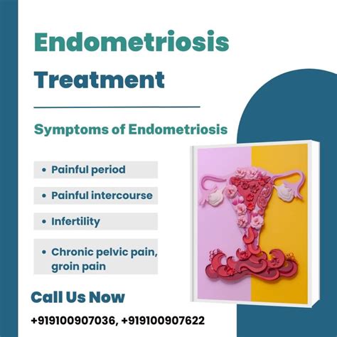 Endometriosis Treatment, Symptoms and Diagnosis | Medintu