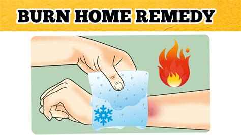 9 Home Remedies For Burn - YouTube