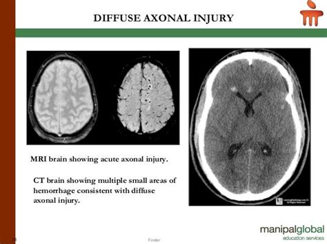 BASICS IN NEUROIMAGING: CT, MRI AND PET