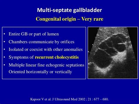 Ultrasound of the gallbladder