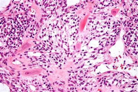 Intermediate trophoblast - Wikiwand