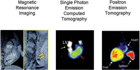 Molecular imaging of stem cells | StemBook