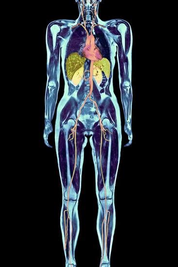 'Full Body Scan, MRI Scan' Photographic Print - Volker Steger | AllPosters.com