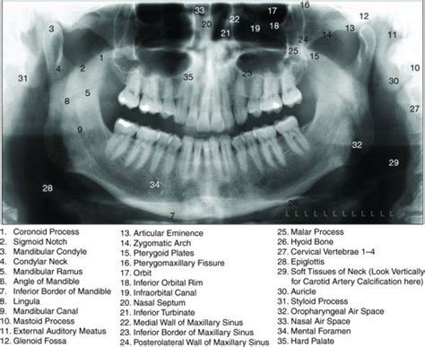 ch03fig001.eps | Dental emergency, Dental hygiene school, Dental