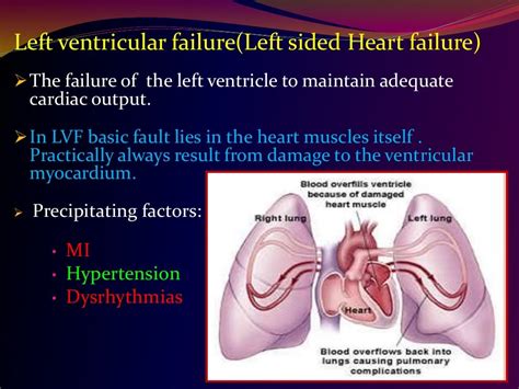 Cardiac Failure