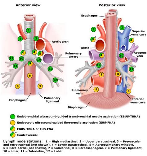 Esophageal Cancer Lymph Nodes