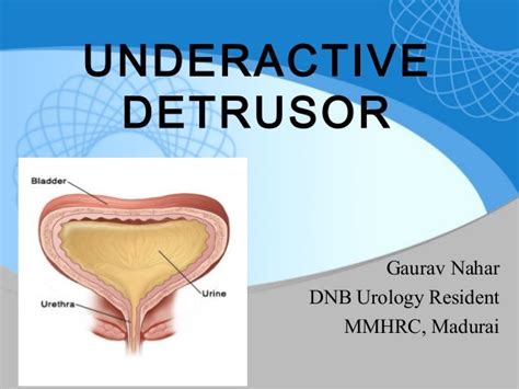 UNDERACTIVE DETRUSOR