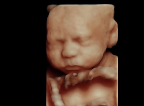 Eight Benefits of 4D Ultrasounds | Lollipop 4D Baby Scans