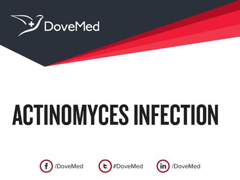 Actinomyces Infection