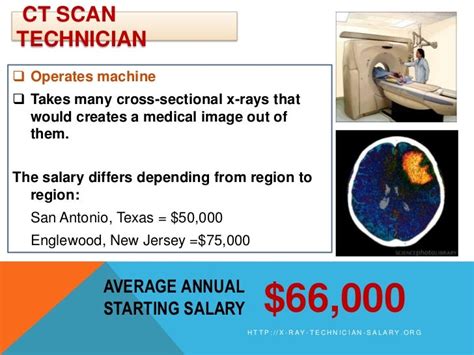 X-Ray Technician Salary