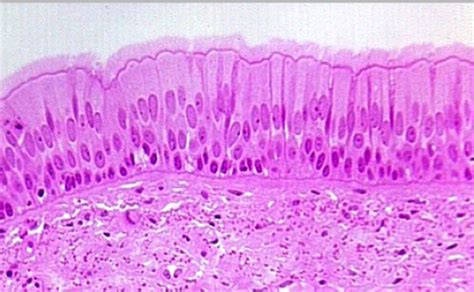 PSEUDOSTRATIFIED COLUMNAR EPITHELIUM | Microanatomy Web Atlas | Gwen V ...