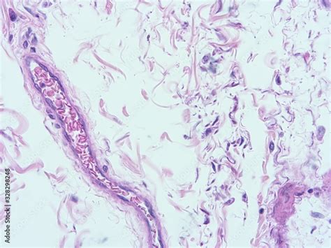 picture of histology human tissue with microscope from laboratory (not Illustration Designation ...