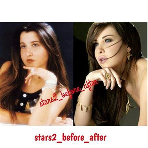 Before after. Nancy ajram | Nancy ajram, Celebrities before and after, Plastic surgery