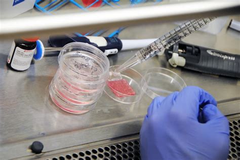 Breakthrough human-like bioprinted skin heals wounds better, faster