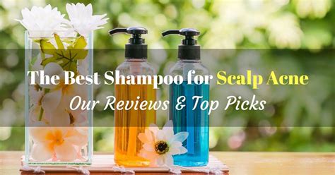 The Best Shampoo for Scalp Acne – 2021 Reviews and Top Picks