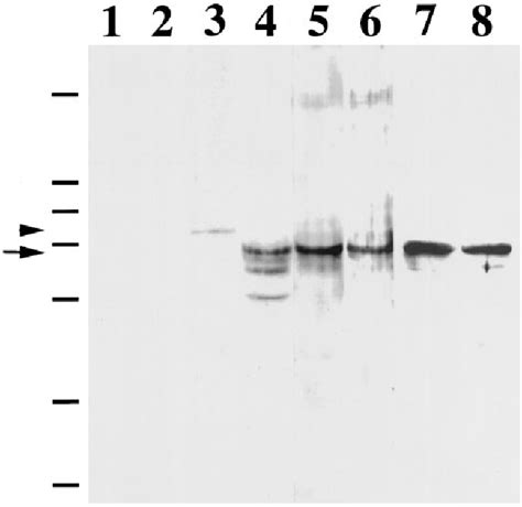 mRNA transport | Semantic Scholar