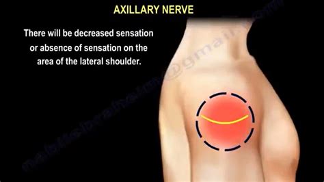 axillary nerve injury, causes, symptoms, diagnosis and treatment ...