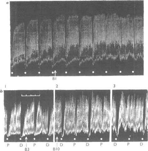 THE ACTIONS OF BRETYLIUM: ADRENERGIC NEURONE BLOCKING AND OTHER EFFECTS - BOURA - 1997 - British ...