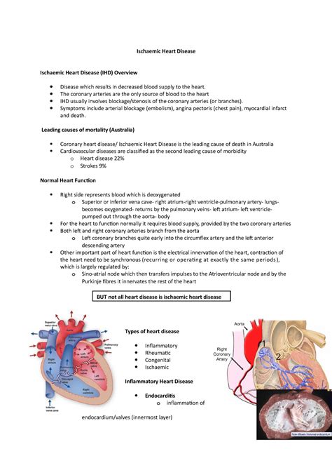 Ischaemic Heart Disease - Ischaemic Heart Disease Ischaemic Heart Disease (IHD) Overview - Studocu