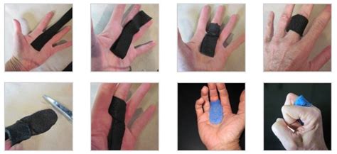 Comparing IP And MCP Joint Splint For Trigger Finger