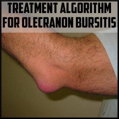 Treatment Algorithm for Olecranon Bursitis - Sports Medicine Review