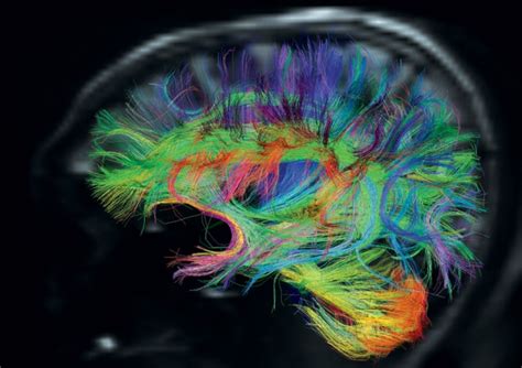 The Brain Circuits Underlying Motivation - Northwest Montessori Preschool