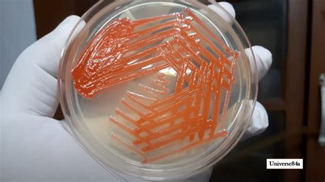 Serratia: Introduction, Classification, Pathogenecityl, Lab Diagnosis, Tre