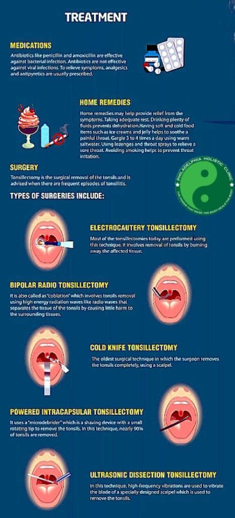 Treatment of Tonsillitis - Philadelphia Holistic Clinic - Dr. Tsan ...