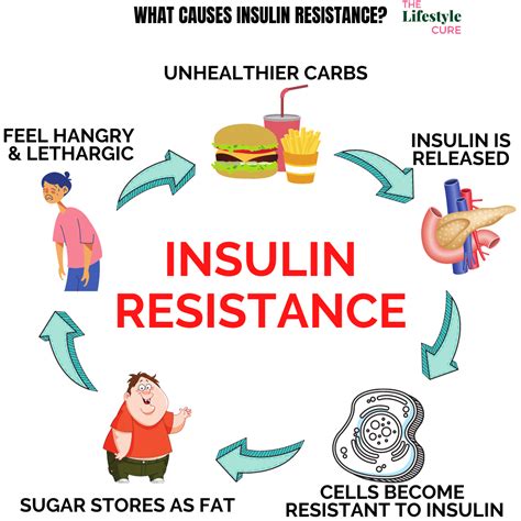 Insulin Resistance Diet for Diabetes