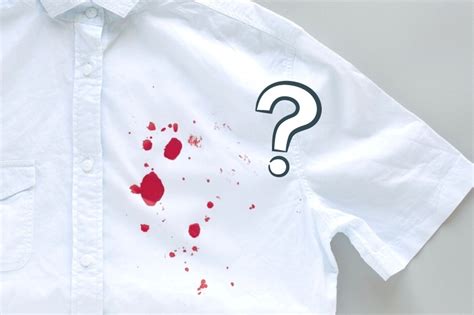 How to Get Blood Out of White Clothes